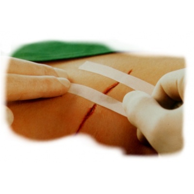 Adhesive sutures